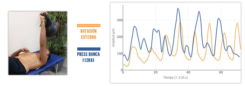 press banca vs rotacion externa en fortalecimiento del serrato
