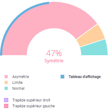 interpréter le signal d'EMG