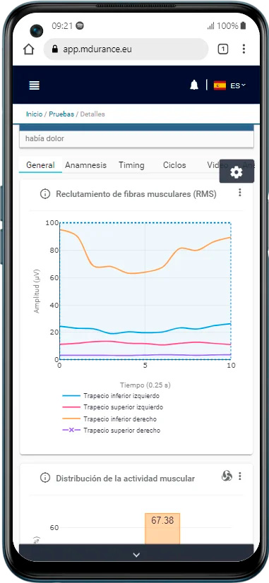 exceso de tono basal