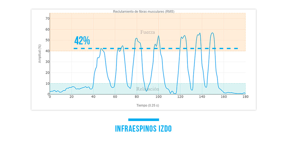 infraespinoso izquierdo