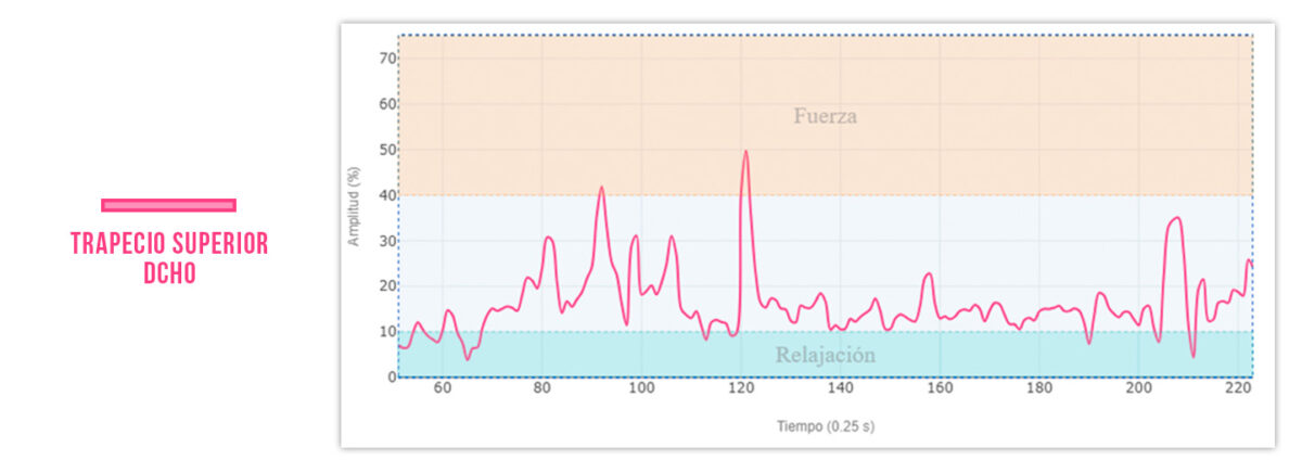 exceso de tono