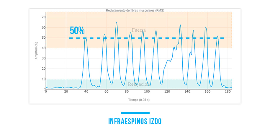 infraespinoso 