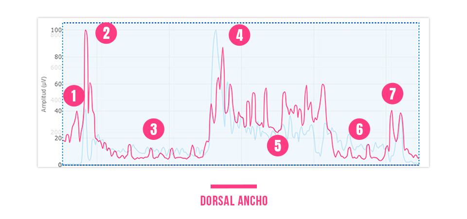 interpretar una gráfica de actividad muscular