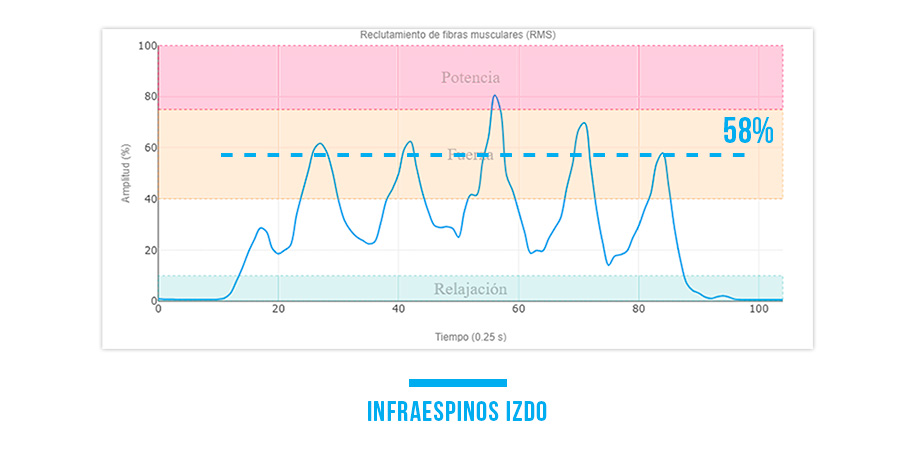 fortalecer el infraespinoso