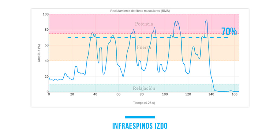 fortalecer el infraespinoso