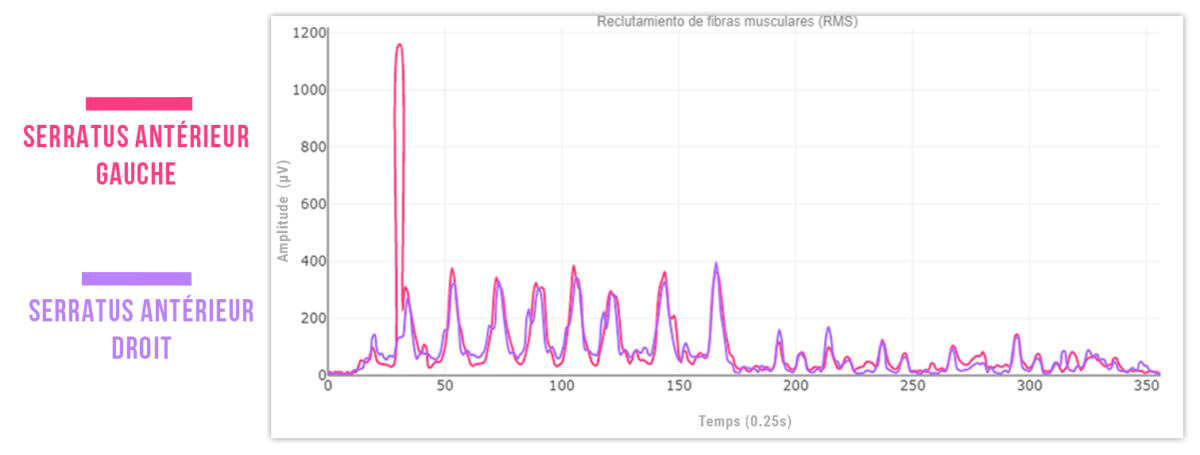 Neuromodulation percutanée