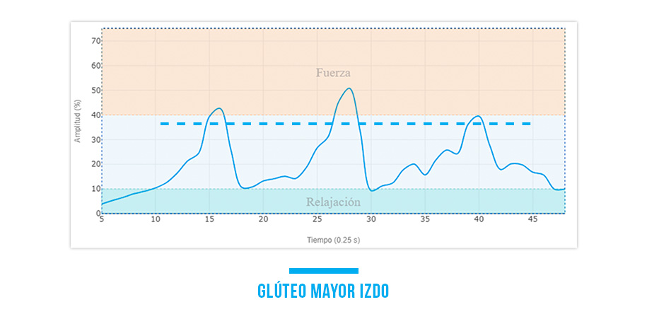 activación del glúteo mayor