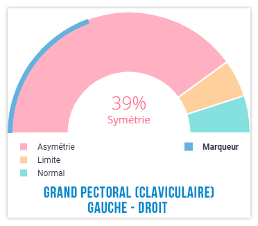 déchirure de la coiffe des rotateurs