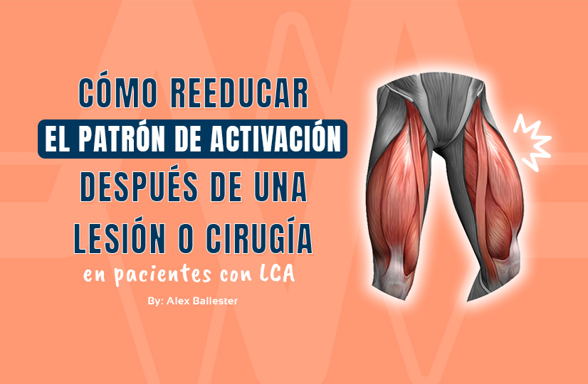 Cómo reeducar el patrón de activación después de una lesión o cirugía en pacientes con LCA