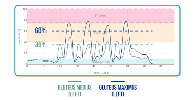 Squat Activates the Gluteus