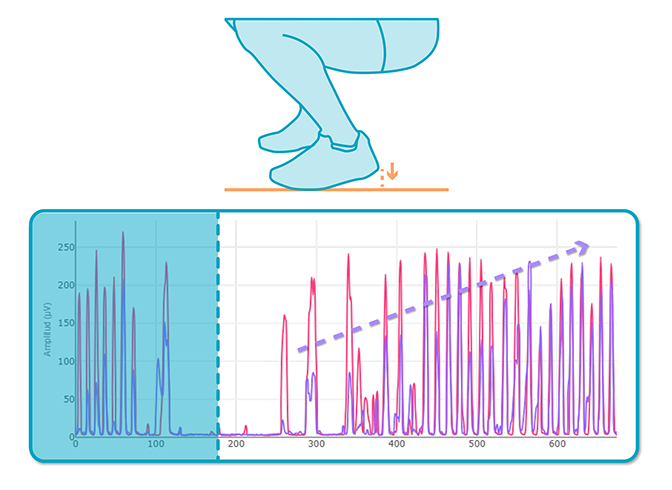 tibial antérieur