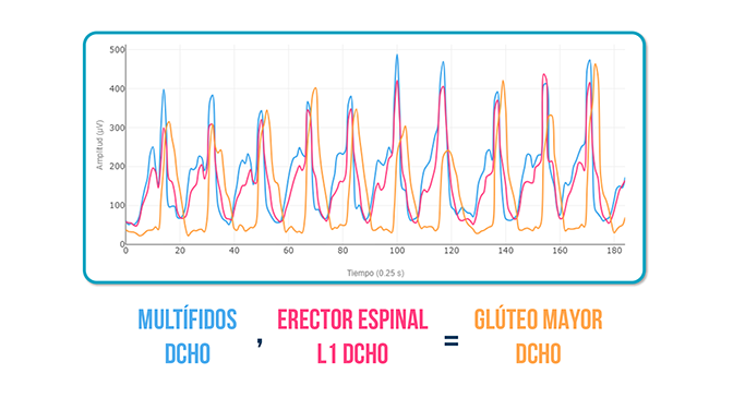 dolor lumbar