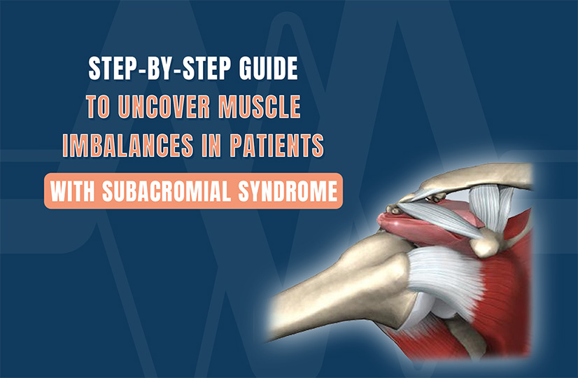 subacromial syndrome