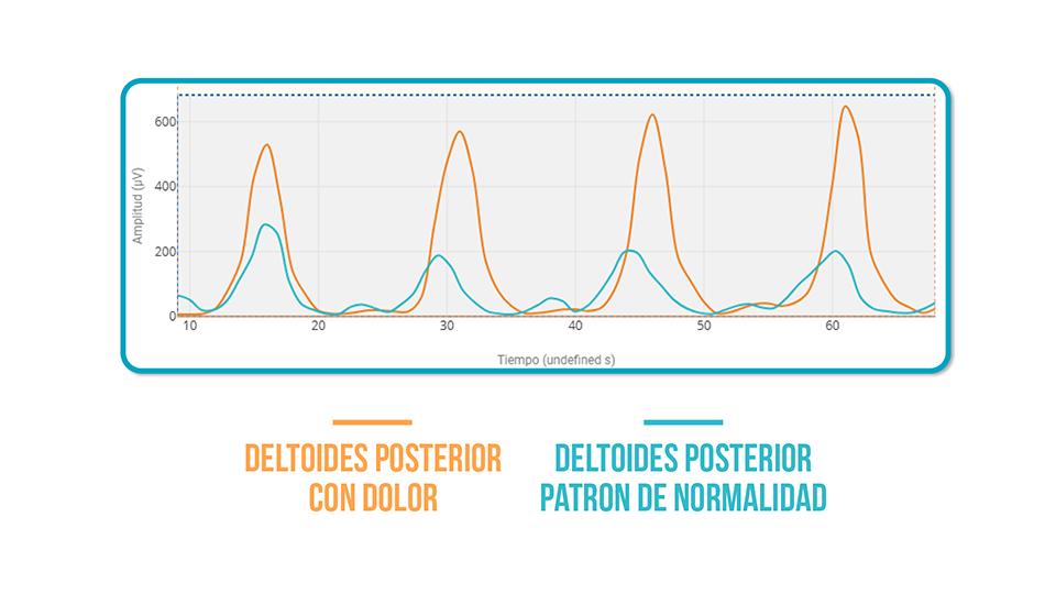 remo horizontal