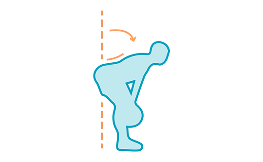 hypertrophie du biceps fémoral