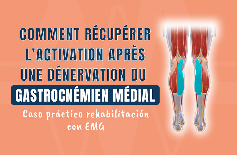 Comment récupérer l’activation après une dénervation du gastrocnémien médial