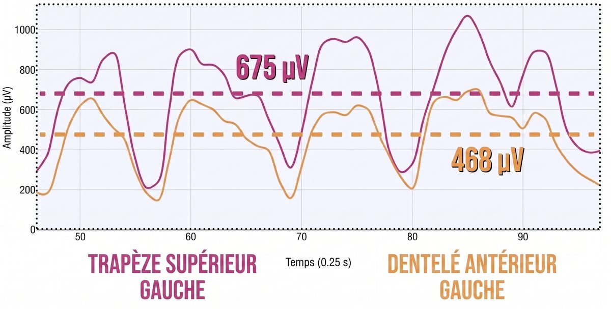 développé épaule